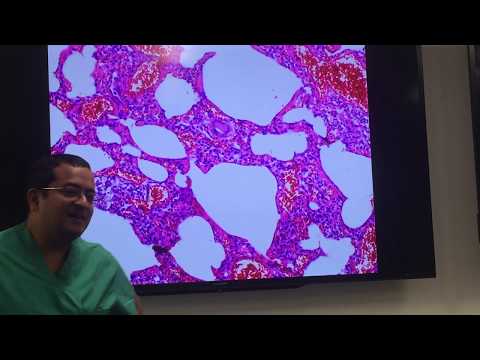 Basics of interstitial lung disease pathology, explained by a pulmonary pathologist