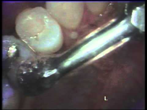 comment se faire rembourser echographie