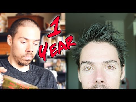 1 Year Male Pattern Baldness Reversal: How I Did It