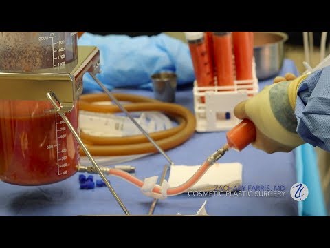 What is a Brazilian Butt Lift? - Farris Plastic Surgery