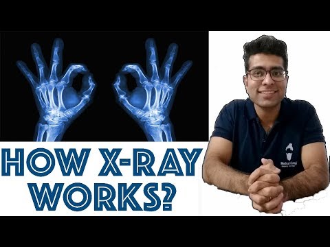How X-RAY works? || How X-rays see through your skin? || Medical Guruji