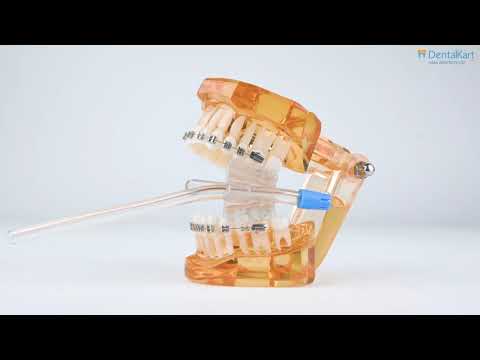 How to use Mouth Prop with Suction Attachment | Bite Block | Dentalkart