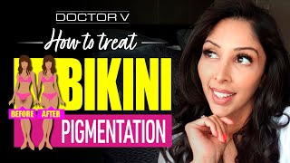 Doctor V - How To Treat Bikini Pigmentation | Skin Of Colour | Brown Or Black Skin