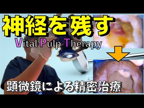 生命歯学科 神経を絶対取るな！マイクロスコープを用いた歯の神経を救う神経温存療法（VPT治療）をご紹介します！