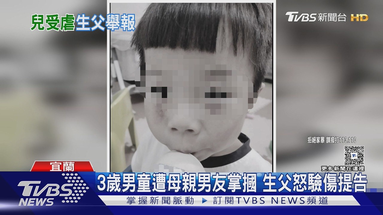宜蘭3歲男童「臉背滿掌痕」遭施暴 生父怒控前妻袒護現任男友