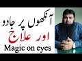 Ankhon Per Jadu Or Ilaj Magic On Eyes Toheedi Rukiya Center Mohammad Ruman Zahoor Jadu