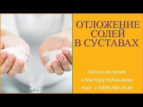 Как убрать отложение солей в суставах? Причины, лечение. Говорит врач остеопат Александр Евдокимов