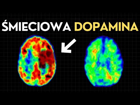 How I Damaged My BRAIN