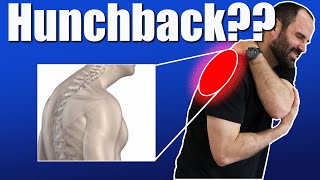 How to Fix a Hunched Back (Hyperkyphosis) | Posture &amp; Pain Relief Exercises