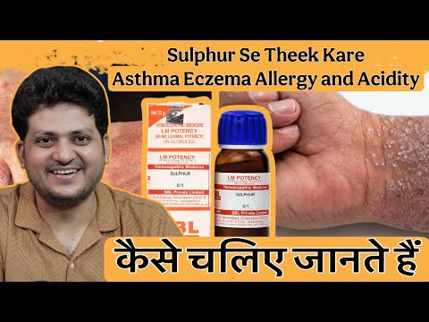 How to Use Sulphur Homeopathic Medicine ? My Experience | Asthma Eczema Allergy & Acidity |