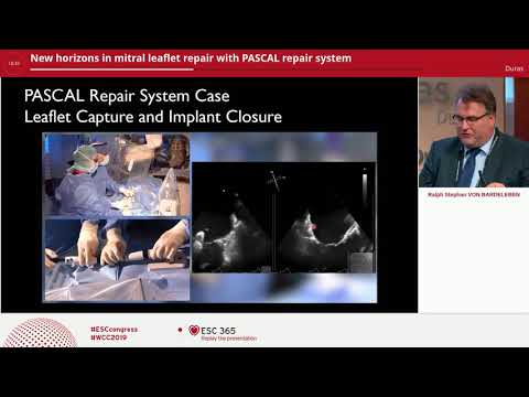 PASCAL repair system - New Horizons in mitral leaflet repair | Edwards Lifesciences symposium at ESC