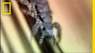 Secret Life of Head Lice | I Didn't Know That