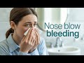 Why Is There Blood When I Blow My Nose