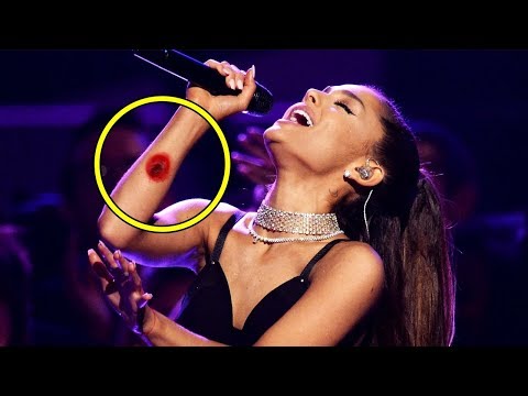 15 Самых Неловких Моментов Знаменитостей