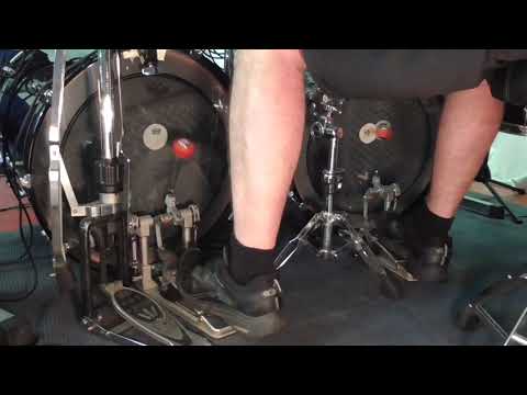 21 Anwendung Ankle Motion 200 bpm