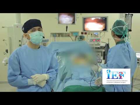 Apa yang harus dilakukan untuk menghadapi tipis Cara menurunkan berat badan dengan berpuasa selama 1 hari