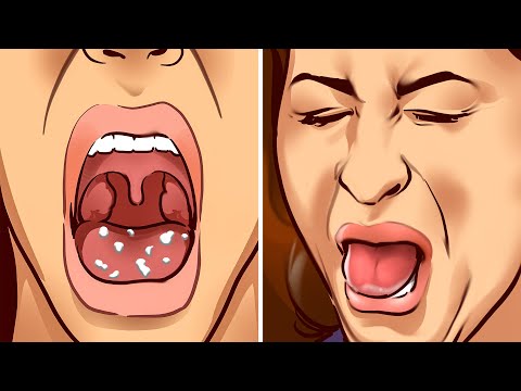 10 Ways to Stop Bad Breath and Get Rid of Mouth Bacteria