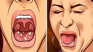 10 Ways to Stop Bad Breath and Get Rid of Mouth Bacteria