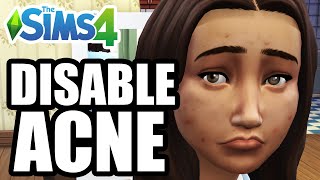 How To Disable/Remove Acne - The Sims 4