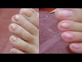 INGROWN REMOVAL PEDICURE CLEANING PAOLA SATISFYING CLIENT72 Chechelegario6373