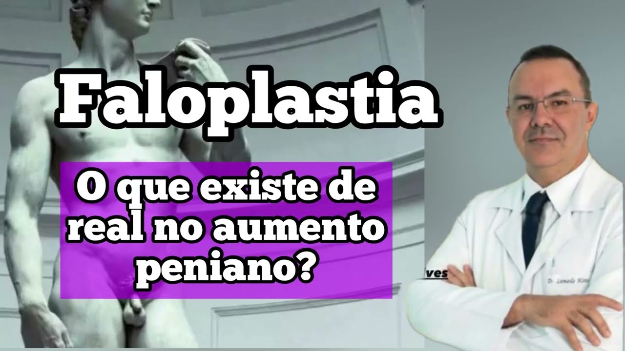 Leonardo De Souza Alves-71