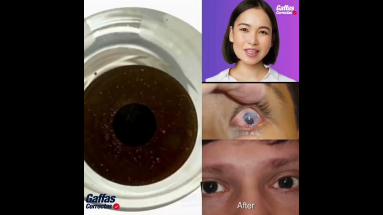 Lente Protésico Pupila Negra Lente Cómodo y Natural - Main Image