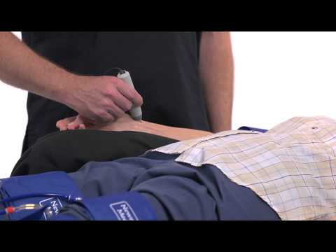 simpleABI with Cuff link-ABI Study