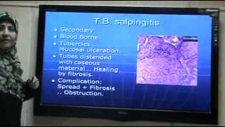 Dr.Sahar - Bacterial Infections 5 - Tuberculous Lymphadenitis - Part 2