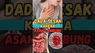 Download lagu Symptoms of Chest Tightness Due to Rising Stomach Acid #shorts #kliperchannel #healthinfo mp3