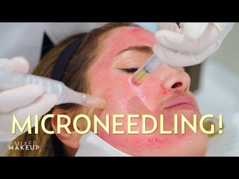  PRP in Holywood - Medaesthetics