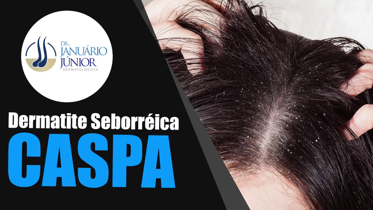 Januário Júnior-30