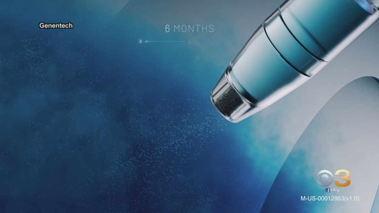 Wills Eye Hospital Leads Research For Recently FDA-Approved Treatment For Eye Disease, Macular Degen