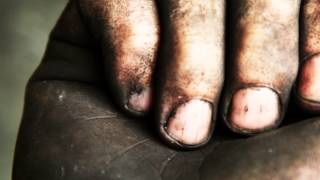 Unter meinem Fingernagel Musikvideo