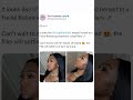 Caresha Please YungMiami Gets A Facial Balancing Treatment With Filler Fillers Yungmiami305