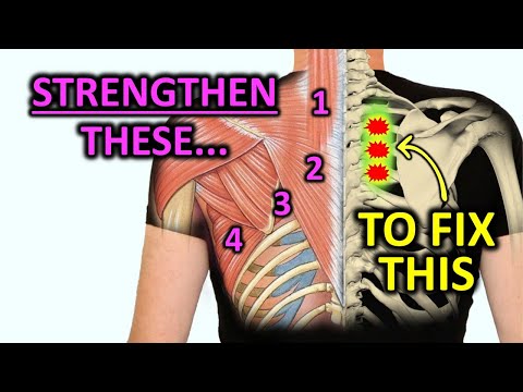 Strengthen These Muscles To Fix Rhomboid Pain