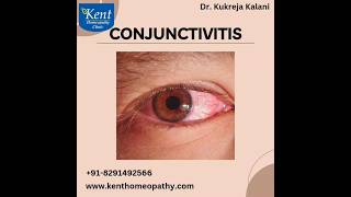 Conjunctivitis -Best homeopathy treatment Drkukreja kalani online consult 8291492566