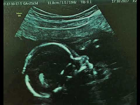 Inno alla vita _OXY_(OXY prod.)