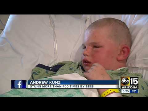 Boy recovering after bee attack in Safford