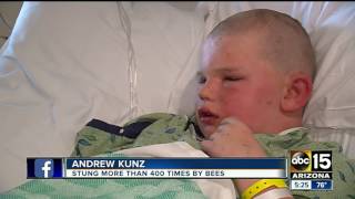 Boy recovering after bee attack in Safford
