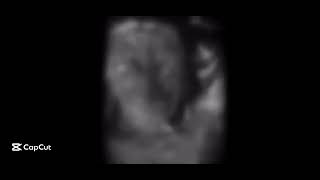 Yo quiero agua (full video) _\||\\\\||—