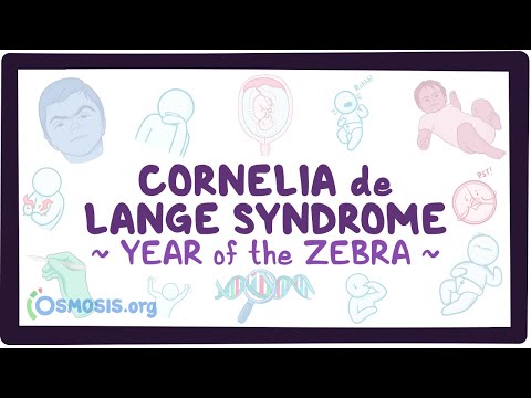 Achalasia Year of the Zebra