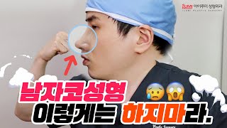 남자코성형 이렇게만은 하지말자! 잘되는법 ✌ #아이루미성형외과