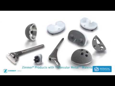 Трабекулярная имплантация Zimmer - революционный материал
