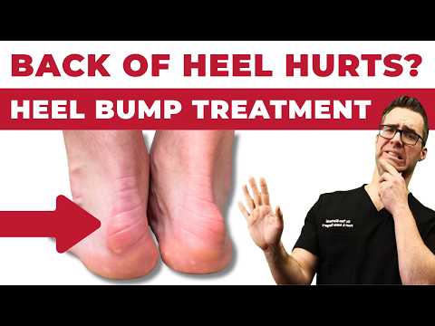 Heel Spurs Plantar Fasciitis BEST Home Treatment 2022