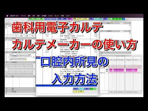エプレポクネミディナ科について詳しく解説