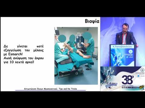 Παπαβασιλείου Κ. - Αντιμετώπιση όγκων μυοσκελετικού. Tips and not tricks