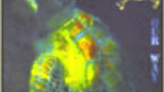 Cadaveres de Tortugas- My Way