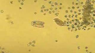 Paramecium caudatum in conjugation