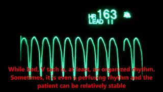 Cardiac Arrest Video