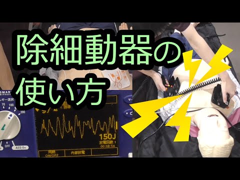 除細動について詳しく解説